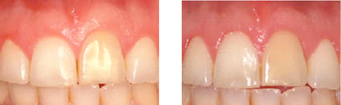 periodontia2