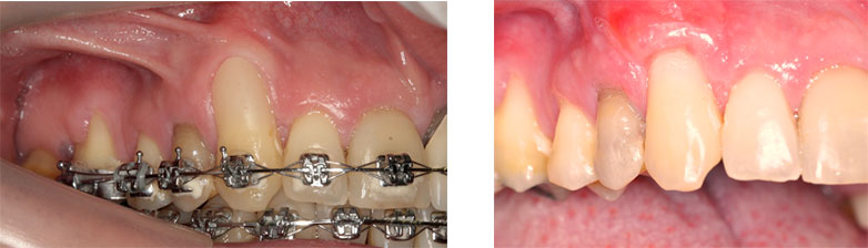 periodontia3